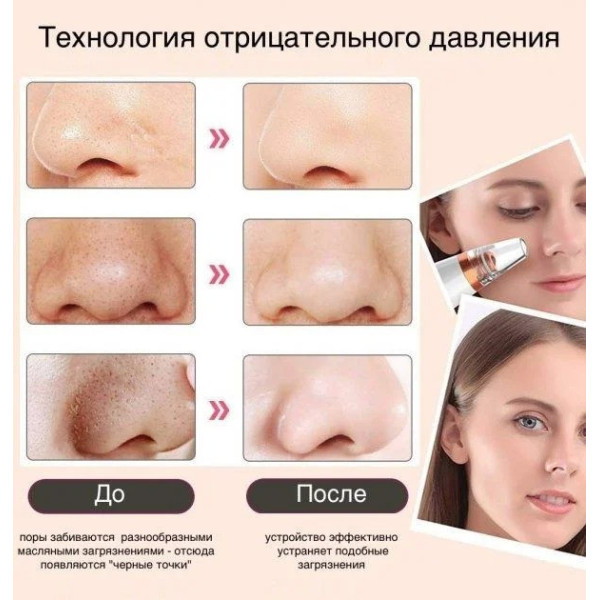 Вакуумный аппарат для очистки кожи и пор Multi-Functional