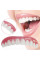 Инновационные виниры Perfect Smile