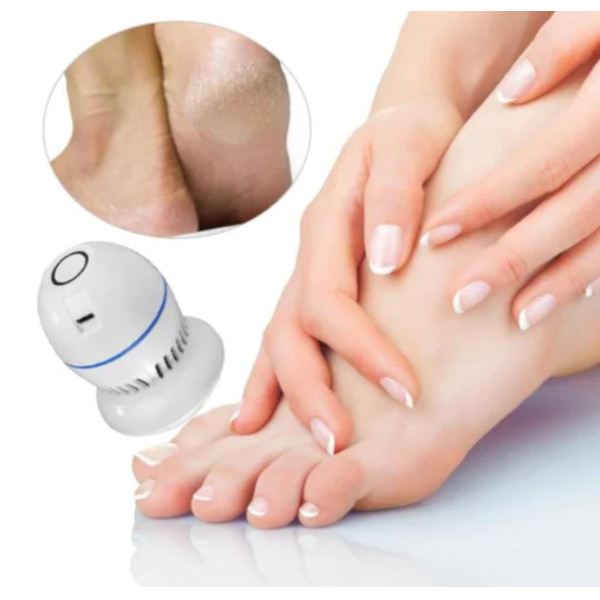 Электрическая пемза PEDI VAC, прибор для удаления мозолей