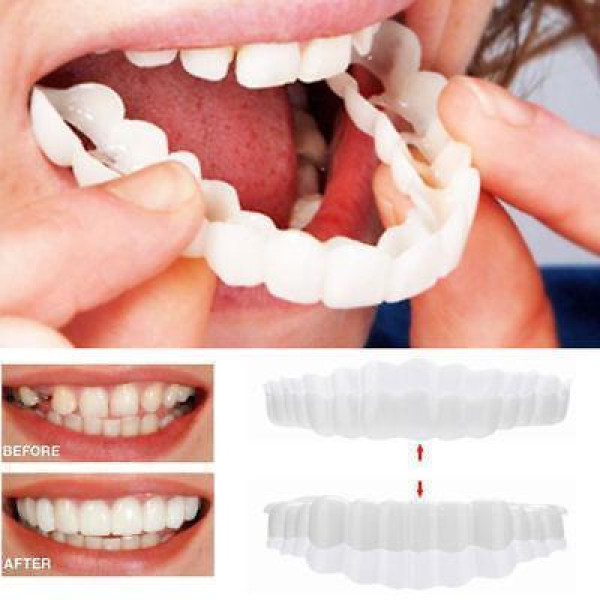Знімні вініри Veneers  smile
