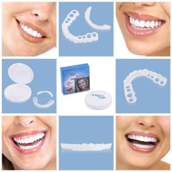 Знімні вініри Veneers  smile