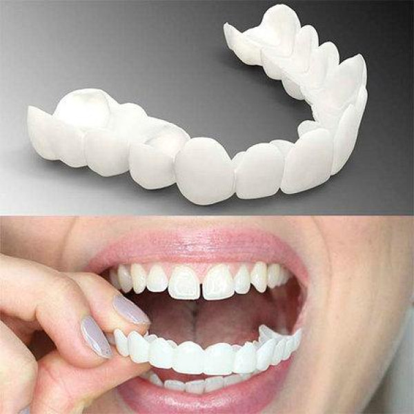 Знімні вініри Veneers  smile